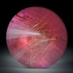 Granat mit Rutilquarz doublettiert und unterlegt mit Perlmutter 168.99ct. runde Form facettiert ca.42x42x19mm